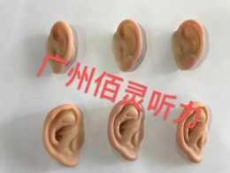 關於小耳畸形的再造——5D義耳贗復技術