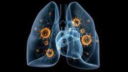 肺心病是什麼原因引起的？嚴重嗎？