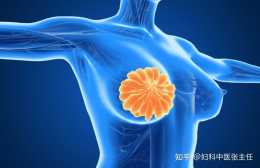 女金中醫張主任：乳腺纖維瘤是惡性腫瘤嗎